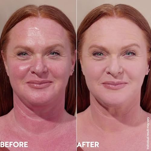 M. Asam Magic Finish Make-Up Mousse (1.01 Fl Oz) – 4in1 Primer, Foundation, Concealer & Powder With Buildable Coverage, Hides Redness And Dark Spots, Vegan, For Light To Medium Skin Tones