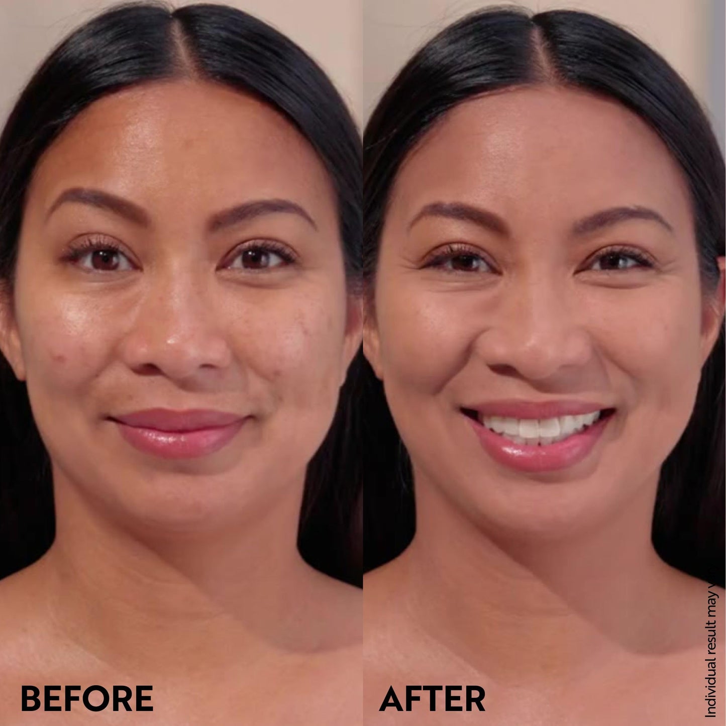 M. Asam Magic Finish Make-Up Mousse (1.01 Fl Oz) – 4in1 Primer, Foundation, Concealer & Powder With Buildable Coverage, Hides Redness And Dark Spots, Vegan, For Light To Medium Skin Tones