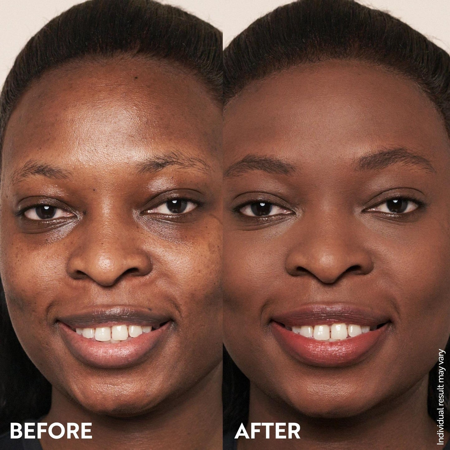 M. Asam Magic Finish Make-Up Mousse (1.01 Fl Oz) – 4in1 Primer, Foundation, Concealer & Powder With Buildable Coverage, Hides Redness And Dark Spots, Vegan, For Light To Medium Skin Tones