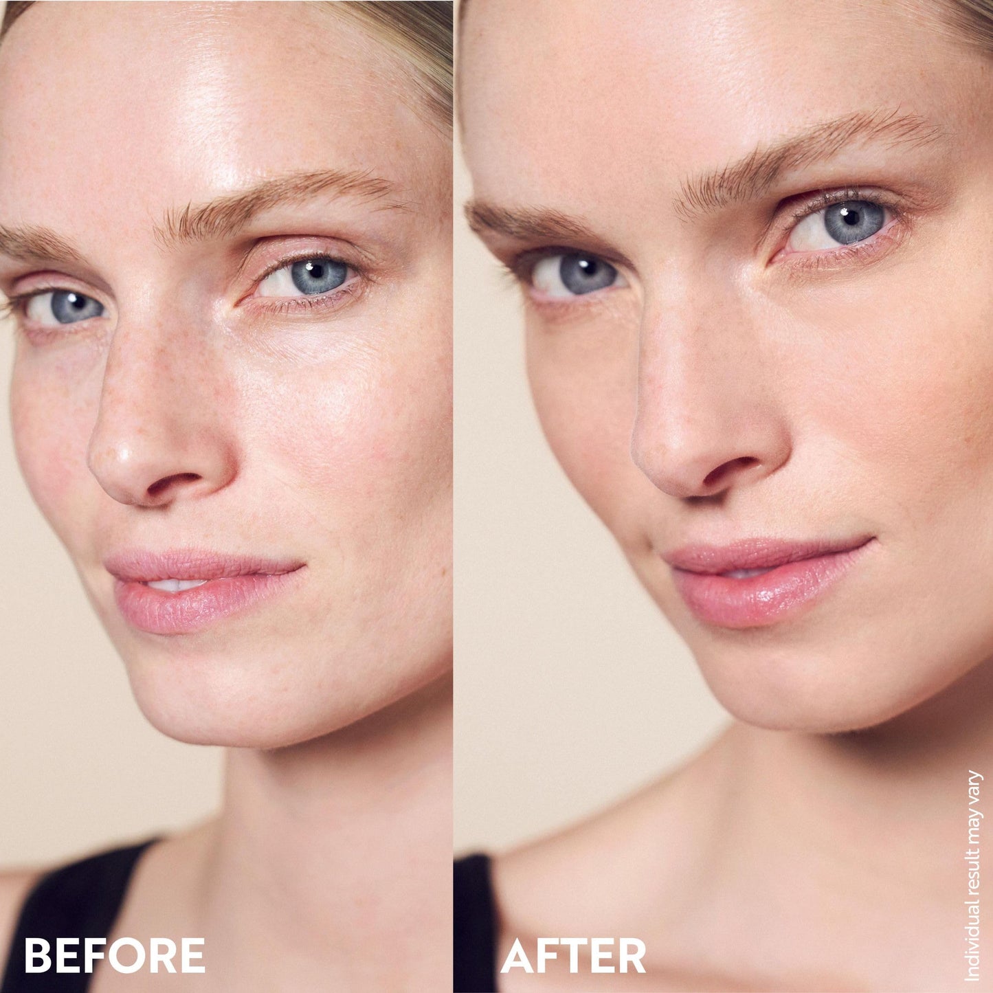 M. Asam Magic Finish Make-Up Mousse (1.01 Fl Oz) – 4in1 Primer, Foundation, Concealer & Powder With Buildable Coverage, Hides Redness And Dark Spots, Vegan, For Light To Medium Skin Tones