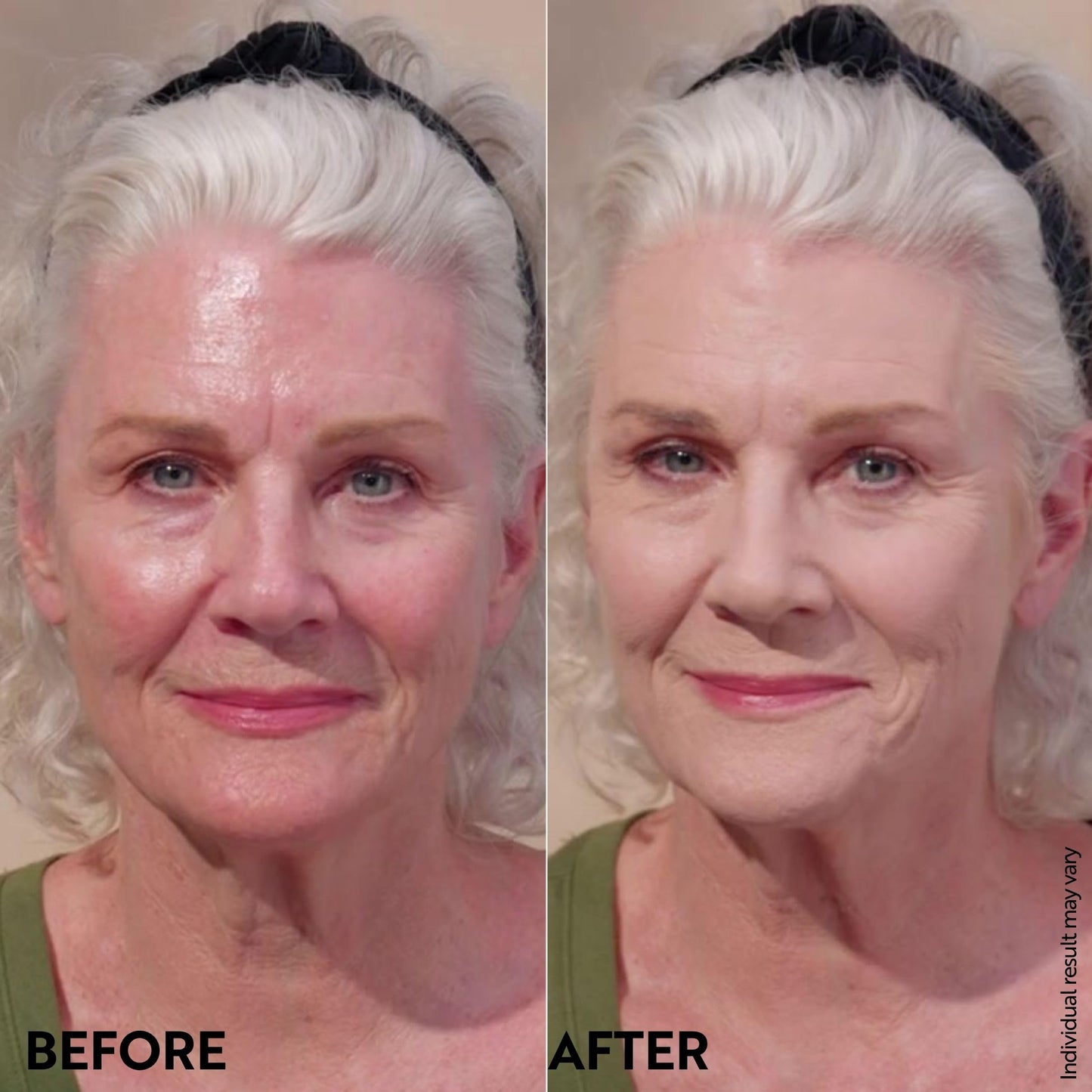 M. Asam Magic Finish Make-Up Mousse (1.01 Fl Oz) – 4in1 Primer, Foundation, Concealer & Powder With Buildable Coverage, Hides Redness And Dark Spots, Vegan, For Light To Medium Skin Tones