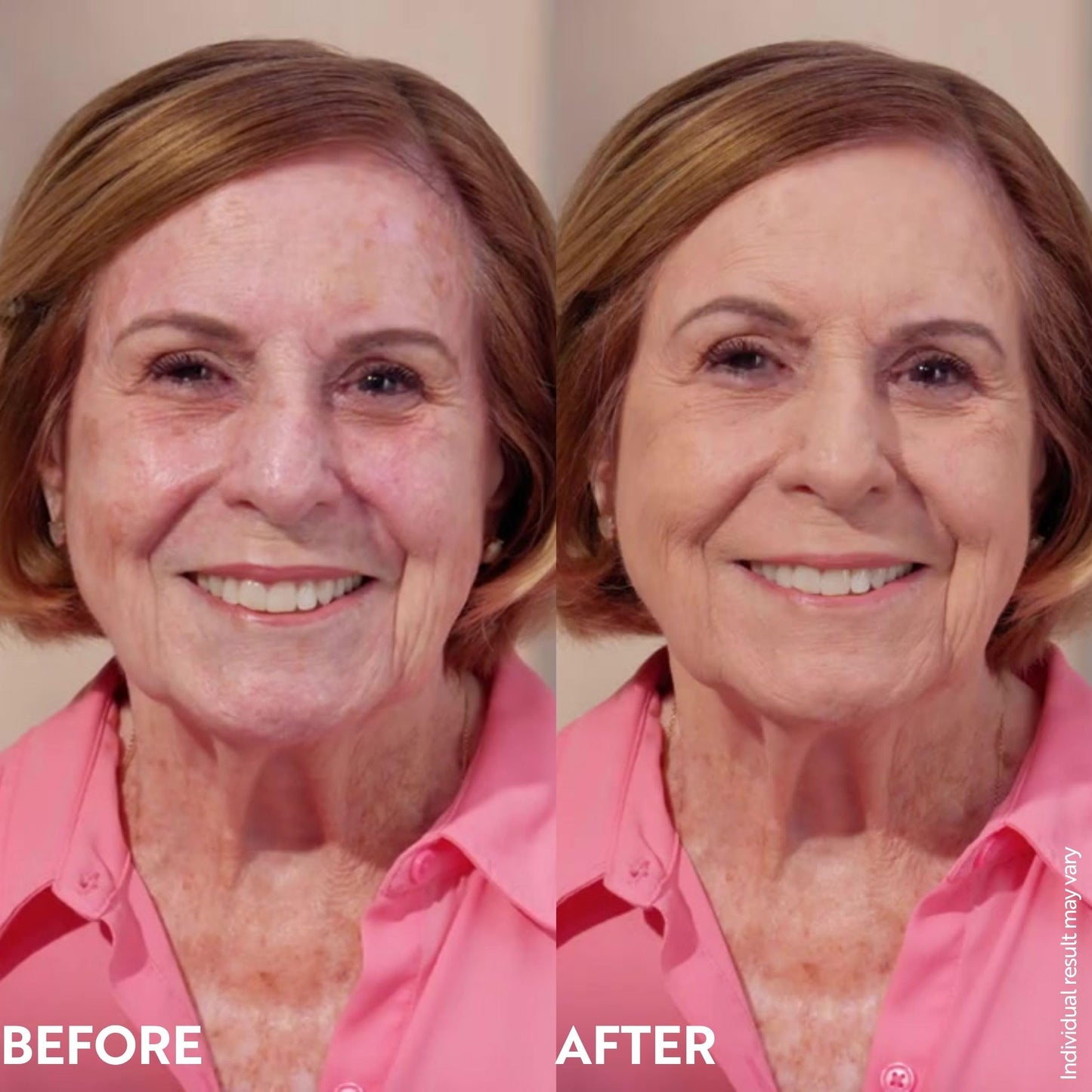 M. Asam Magic Finish Make-Up Mousse (1.01 Fl Oz) – 4in1 Primer, Foundation, Concealer & Powder With Buildable Coverage, Hides Redness And Dark Spots, Vegan, For Light To Medium Skin Tones