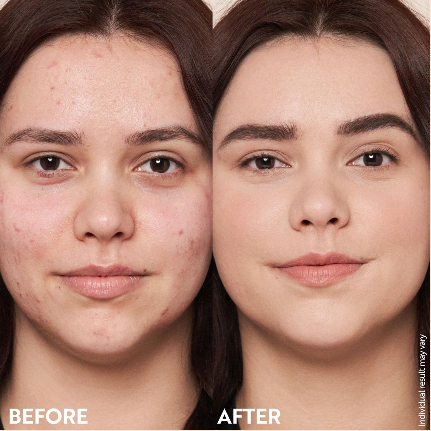 M. Asam Magic Finish Make-Up Mousse (1.01 Fl Oz) – 4in1 Primer, Foundation, Concealer & Powder With Buildable Coverage, Hides Redness And Dark Spots, Vegan, For Light To Medium Skin Tones