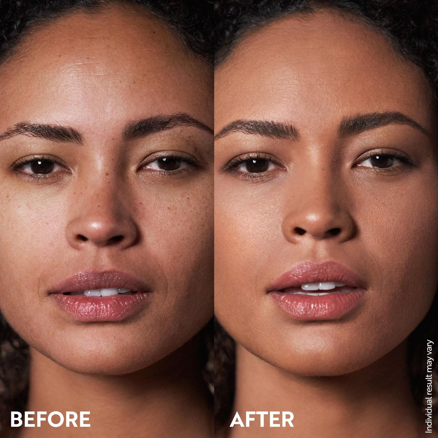 M. Asam Magic Finish Make-Up Mousse (1.01 Fl Oz) – 4in1 Primer, Foundation, Concealer & Powder With Buildable Coverage, Hides Redness And Dark Spots, Vegan, For Light To Medium Skin Tones