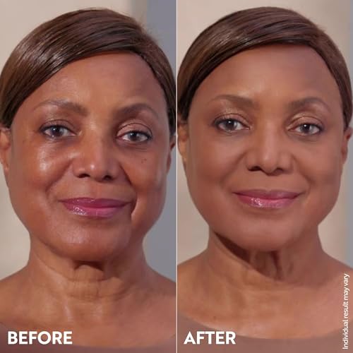 M. Asam Magic Finish Make-Up Mousse (1.01 Fl Oz) – 4in1 Primer, Foundation, Concealer & Powder With Buildable Coverage, Hides Redness And Dark Spots, Vegan, For Light To Medium Skin Tones