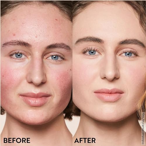 M. Asam Magic Finish Make-Up Mousse (1.01 Fl Oz) – 4in1 Primer, Foundation, Concealer & Powder With Buildable Coverage, Hides Redness And Dark Spots, Vegan, For Light To Medium Skin Tones