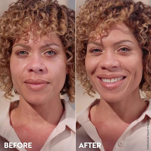 M. Asam Magic Finish Make-Up Mousse (1.01 Fl Oz) – 4in1 Primer, Foundation, Concealer & Powder With Buildable Coverage, Hides Redness And Dark Spots, Vegan, For Light To Medium Skin Tones