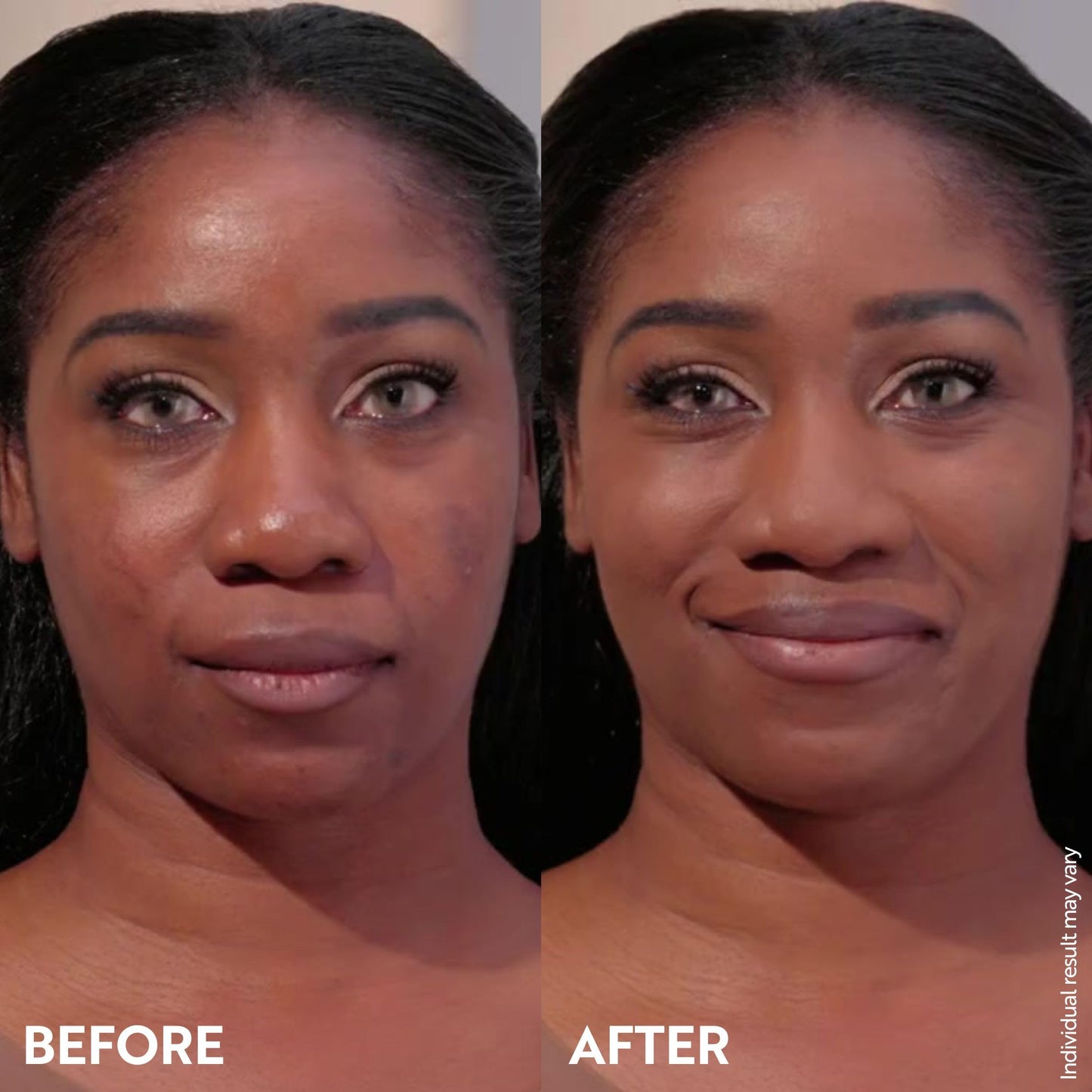 M. Asam Magic Finish Make-Up Mousse (1.01 Fl Oz) – 4in1 Primer, Foundation, Concealer & Powder With Buildable Coverage, Hides Redness And Dark Spots, Vegan, For Light To Medium Skin Tones