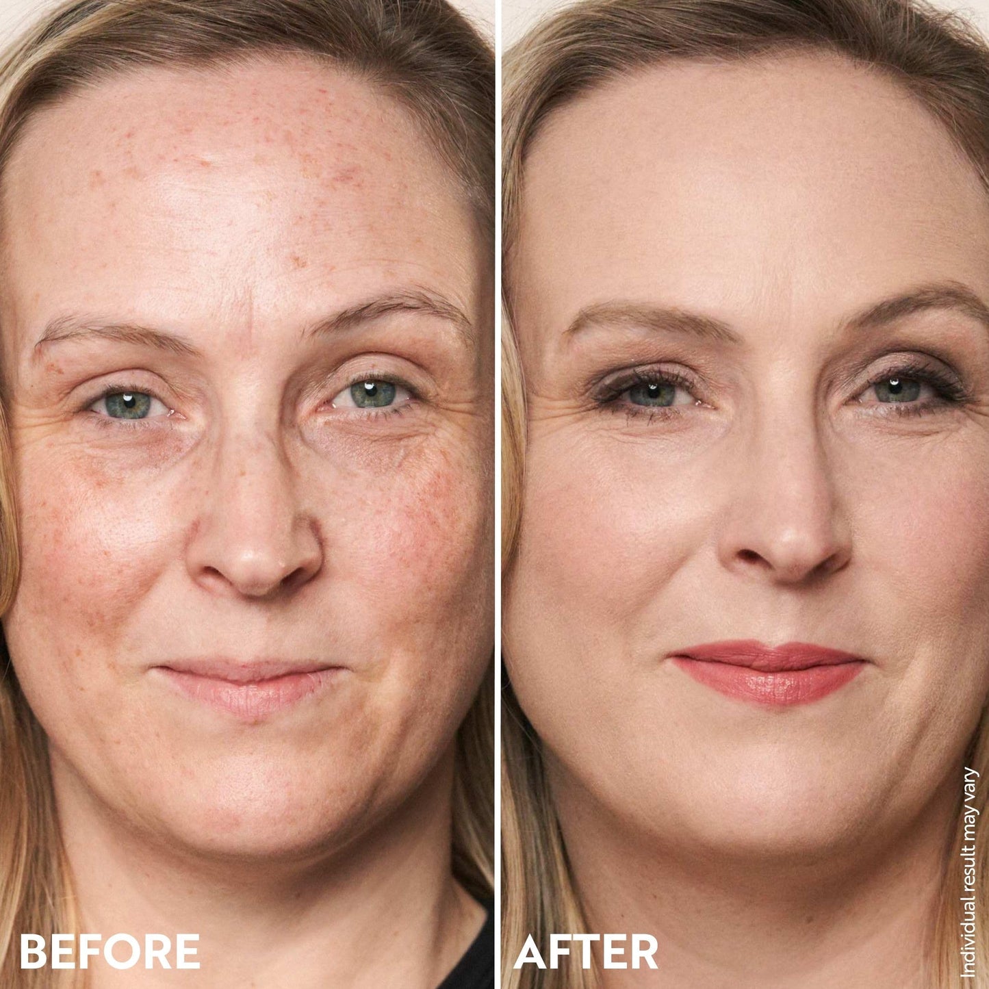 M. Asam Magic Finish Make-Up Mousse (1.01 Fl Oz) – 4in1 Primer, Foundation, Concealer & Powder With Buildable Coverage, Hides Redness And Dark Spots, Vegan, For Light To Medium Skin Tones