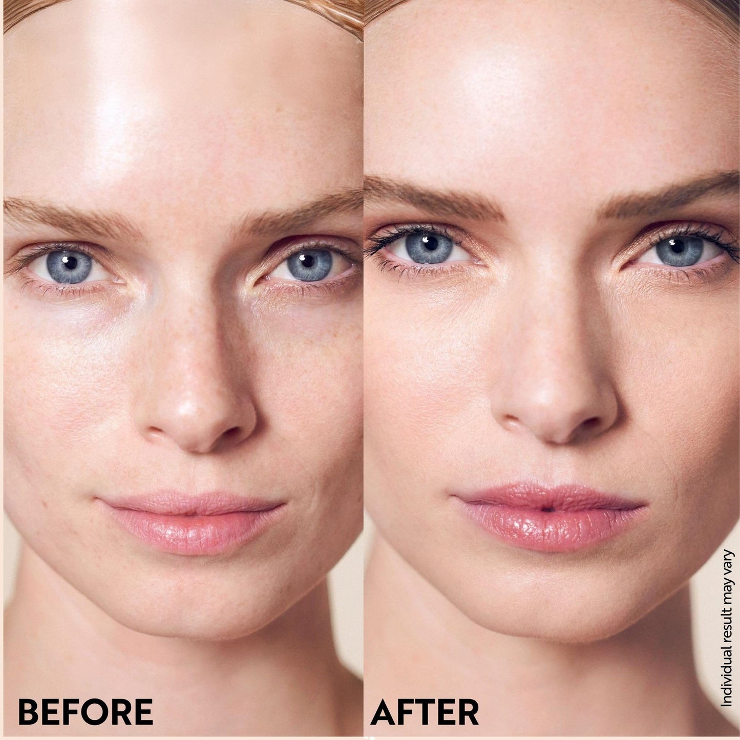 M. Asam Magic Finish Make-Up Mousse (1.01 Fl Oz) – 4in1 Primer, Foundation, Concealer & Powder With Buildable Coverage, Hides Redness And Dark Spots, Vegan, For Light To Medium Skin Tones