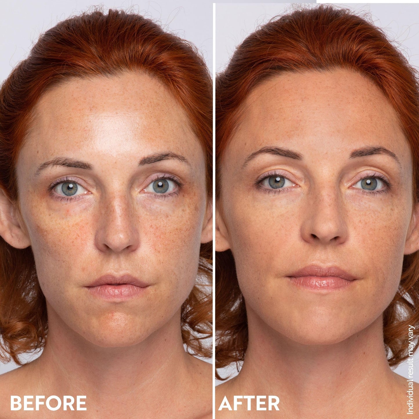 M. Asam Magic Finish Make-Up Mousse (1.01 Fl Oz) – 4in1 Primer, Foundation, Concealer & Powder With Buildable Coverage, Hides Redness And Dark Spots, Vegan, For Light To Medium Skin Tones